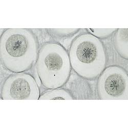 Bresser Optik Dauerpräparate Profi 10er 136815 mikroskopická sklíčka